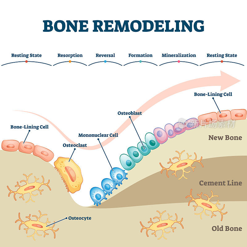 Bone remodeling process educational explanation with labeled structure scheme